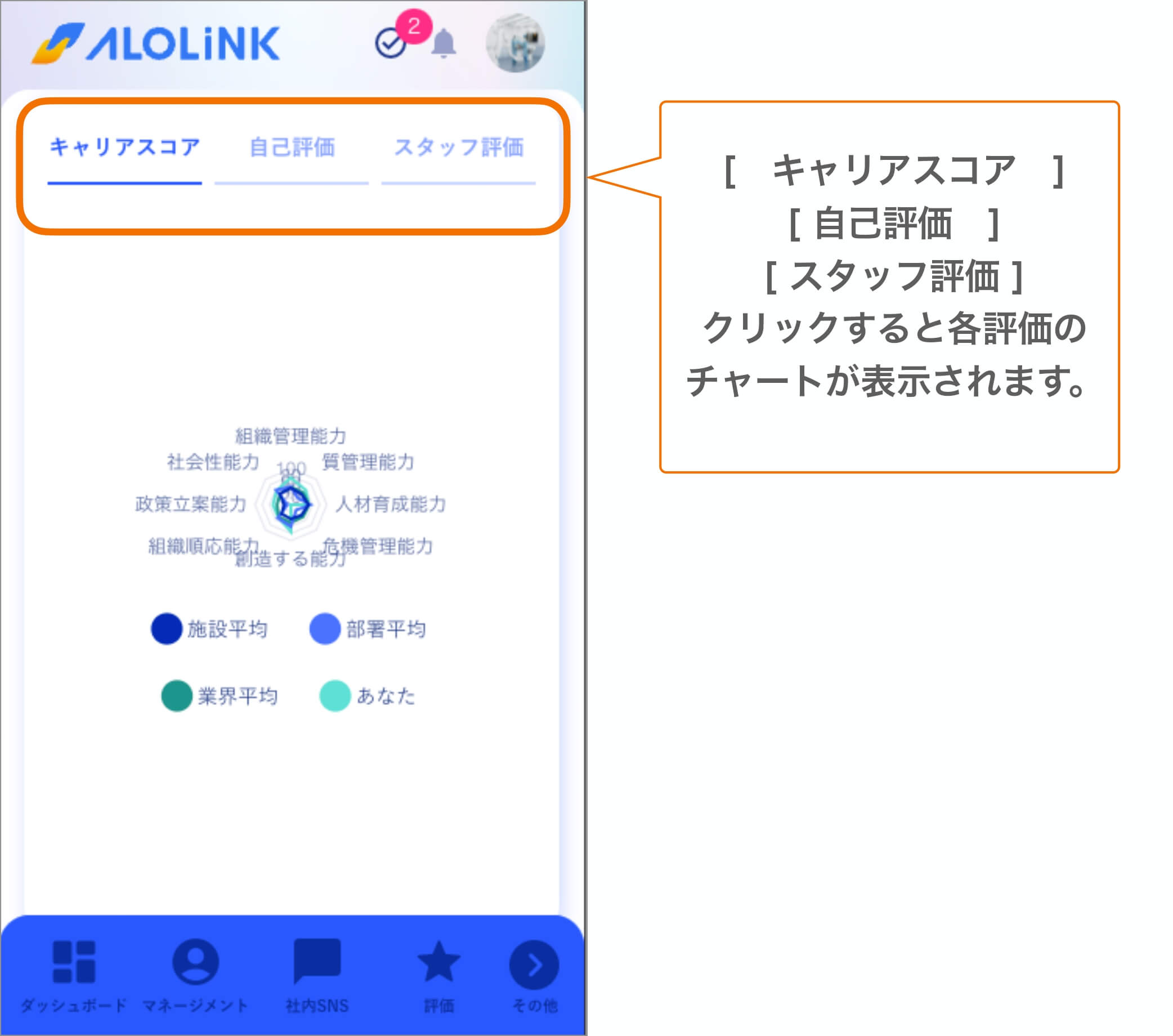 レーダーチャート